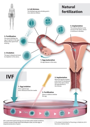 ‘시험관 아기’의 시작은 어떻게 가능했나…노벨상, IVF 개척자 로버트 에드워즈 조명